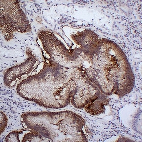 Claudin 18 Mouse Monoclonal Antibody(C2321)