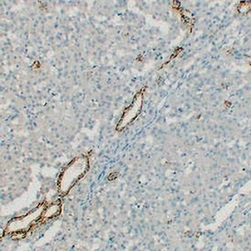 Claudin 7 Mouse Monoclonal Antibody(C2322)