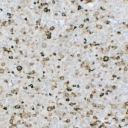 FSH beta Mouse Monoclonal Antibody(C2324)