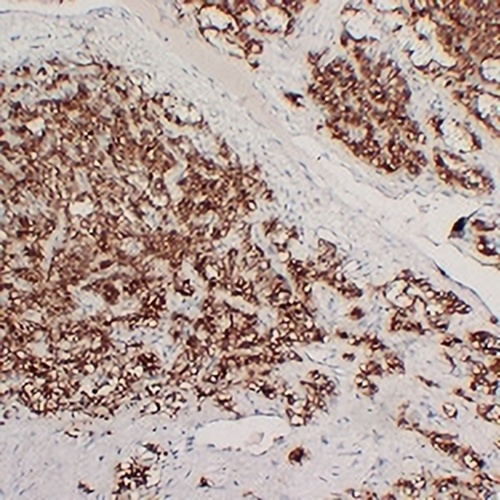 PTH Mouse Monoclonal Antibody(C2326)