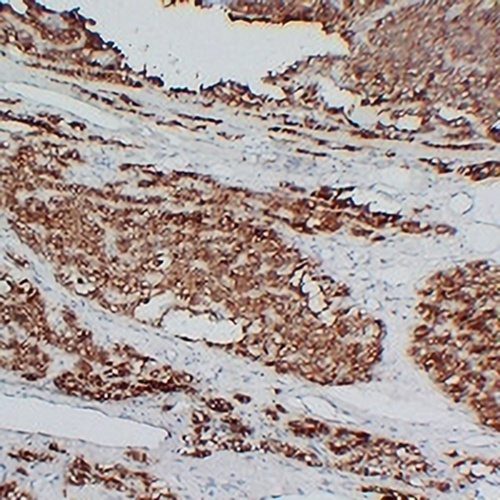 PTH Mouse Monoclonal Antibody(C2327)