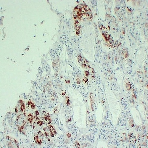 Prolactin Mouse Monoclonal Antibody(C2328)