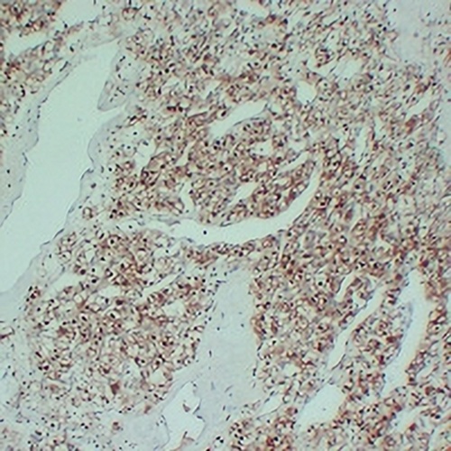 S100-A1 Mouse Monoclonal Antibody(C2329)