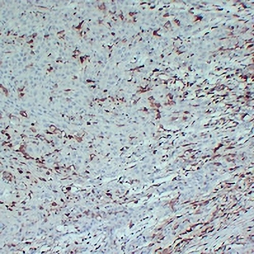 S100-A4 Mouse Monoclonal Antibody(C2330)