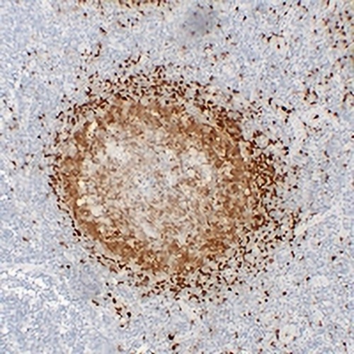 TCL1A Mouse Monoclonal Antibody(C2331)