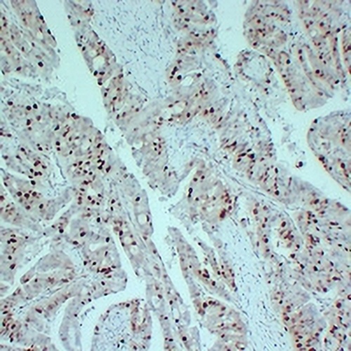 Topoisomerase 2 alpha Mouse Monoclonal Antibody(C2333)