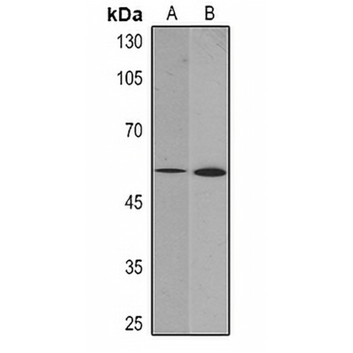 Vimentin Mouse Monoclonal Antibody(C2334)