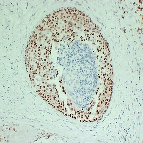 Estrogen Receptor alpha Mouse Monoclonal Antibody(C2336)