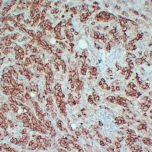 CD63 Mouse Monoclonal Antibody(C2340)