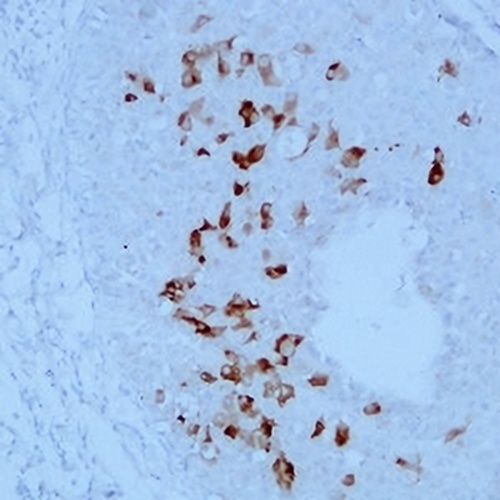 Mammaglobin-A/B Mouse Monoclonal Antibody(C2343)