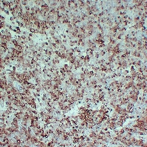 PMEL Mouse Monoclonal Antibody(C2345)