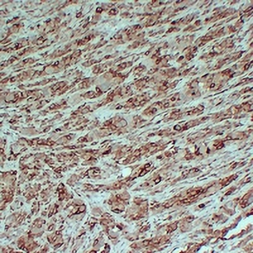 PMEL Mouse Monoclonal Antibody(C2346)