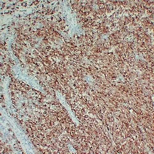 Tyrosinase Mouse Monoclonal Antibody(C2347)