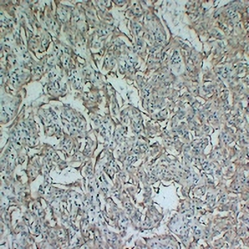 Tyrosinase Mouse Monoclonal Antibody(C2348)