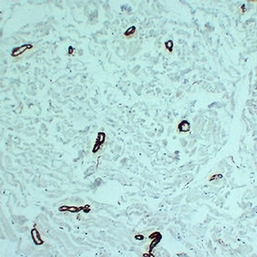 alpha Smooth Muscle Actin Mouse Monoclonal Antibody(C2349)