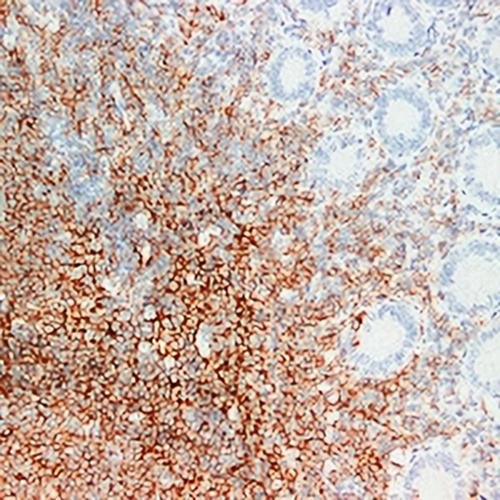 CD20 Mouse Monoclonal Antibody(C2353)