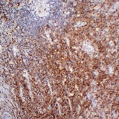 CD38 Mouse Monoclonal Antibody(C2354)