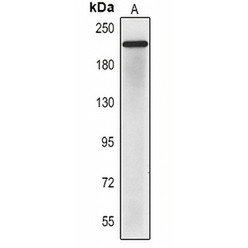 CD56 Mouse Monoclonal Antibody(C2356)