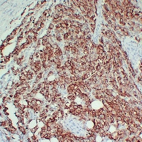 CD63 Mouse Monoclonal Antibody(C2357)