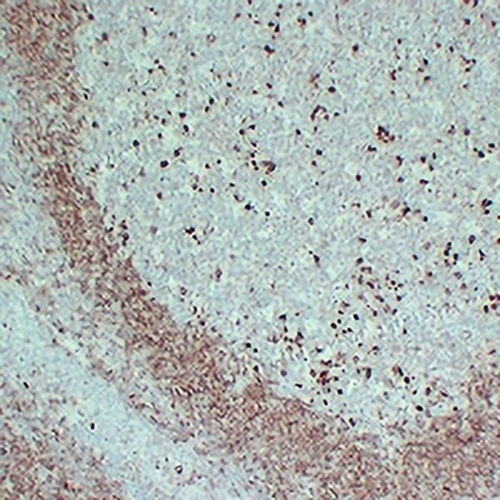 CD79a Mouse Monoclonal Antibody(C2358)