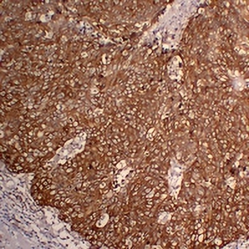 Cytokeratin 5 Mouse Monoclonal Antibody(C2360)