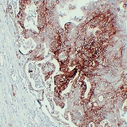 GLUT1 Mouse Monoclonal Antibody(C2361)