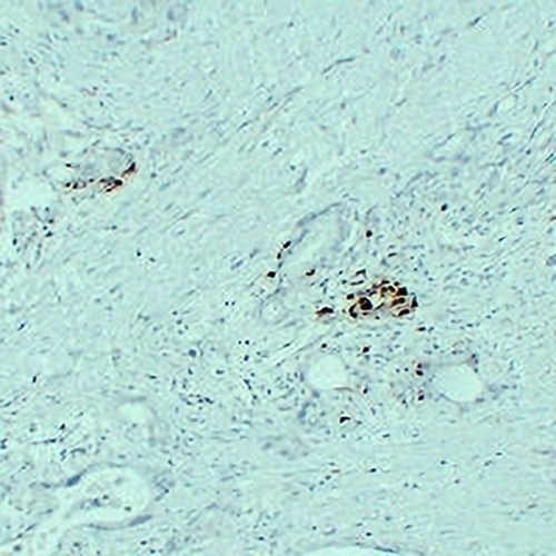 IGF2 Mouse Monoclonal Antibody(C2362)