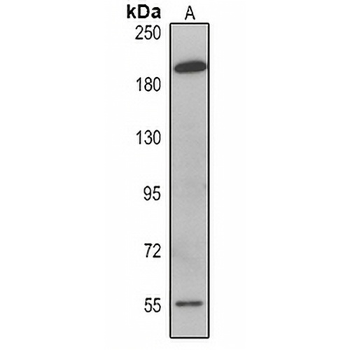 MAGEC1 Mouse Monoclonal Antibody(C2363)