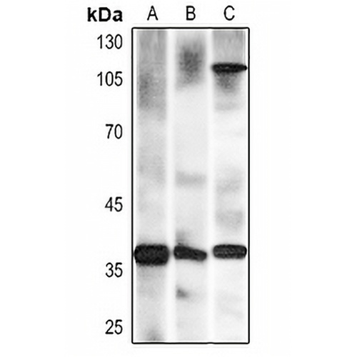 Nucleophosmin Mouse Monoclonal Antibody(C2368)
