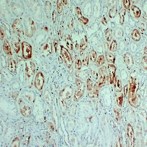S100-A1 Mouse Monoclonal Antibody(C2369)