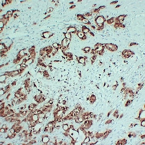 S100-P Mouse Monoclonal Antibody(C2370)
