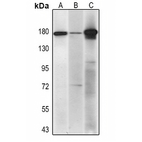 Topoisomerase 2 alpha Mouse Monoclonal Antibody(C2371)