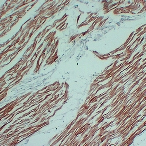 Actin Sarcomeric Muscle Mouse Monoclonal Antibody(C2374)