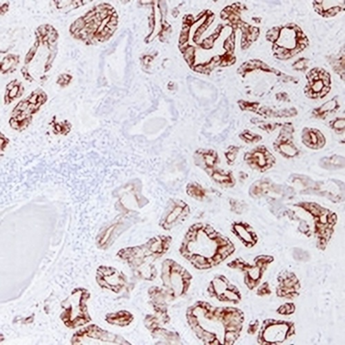 AMACR Mouse Monoclonal Antibody(C2375)