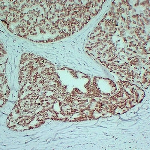 Androgen Receptor Mouse Monoclonal Antibody(C2376)
