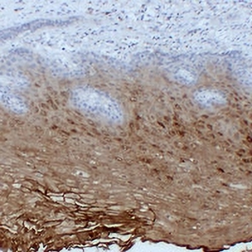 Annexin A1 Mouse Monoclonal Antibody(C2377)