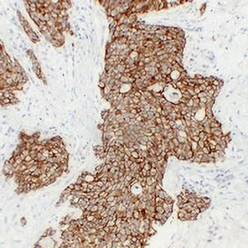 Cadherin pan Mouse Monoclonal Antibody(C2379)