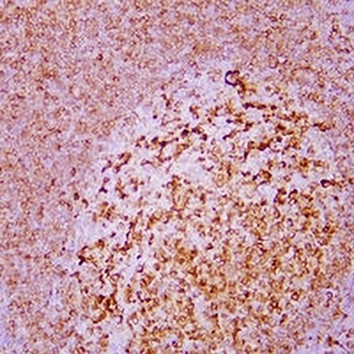 CD74 Mouse Monoclonal Antibody(C2382)
