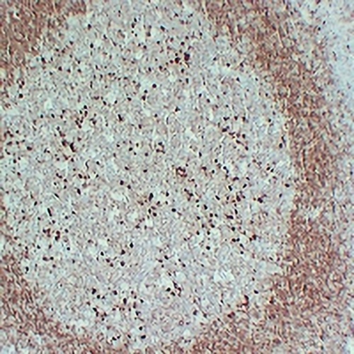 CD79a Mouse Monoclonal Antibody(C2383)