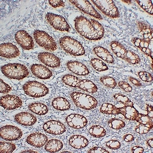Claudin 3 Mouse Monoclonal Antibody(C2385)