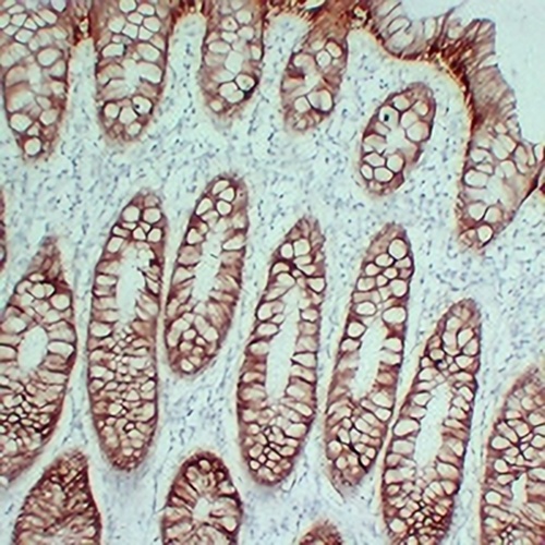 Claudin 4 Mouse Monoclonal Antibody(C2386)