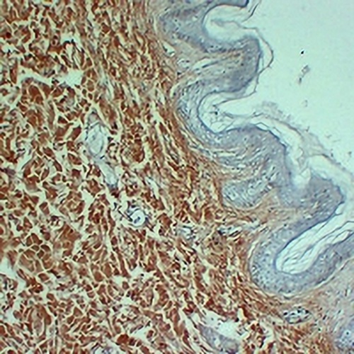 Collagen 3 alpha 1 Mouse Monoclonal Antibody(C2387)