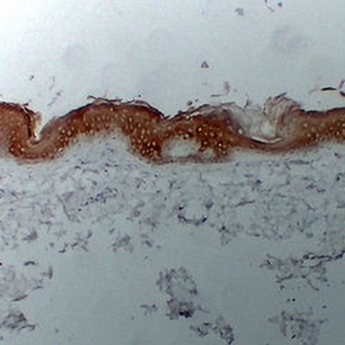 Cytokeratin 1 Mouse Monoclonal Antibody(C2388)