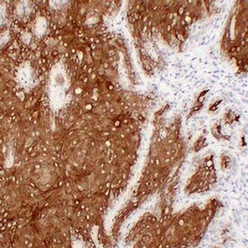Cytokeratin 16 Mouse Monoclonal Antibody(C2389)