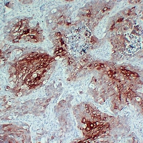 Cytokeratin 17 Mouse Monoclonal Antibody(C2390)
