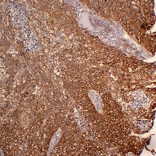 Cytokeratin 5 Mouse Monoclonal Antibody(C2391)