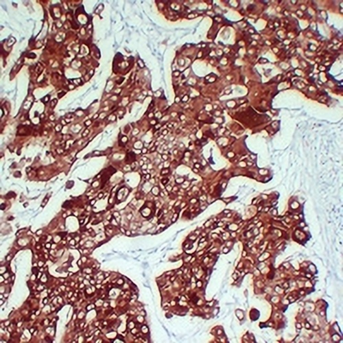 Cytokeratin 6 Mouse Monoclonal Antibody(C2392)