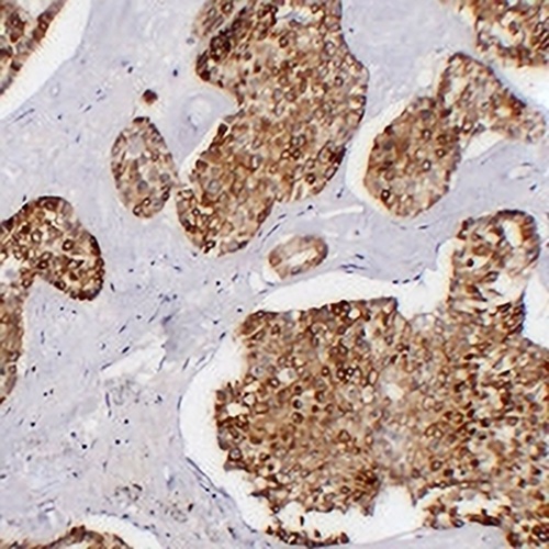 Cytokeratin 7 Mouse Monoclonal Antibody(C2393)
