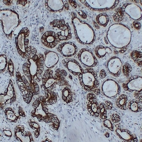 Cytokeratin 8 Mouse Monoclonal Antibody(C2394)