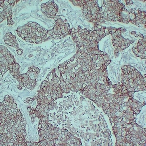 E Cadherin Mouse Monoclonal Antibody(C2395)
